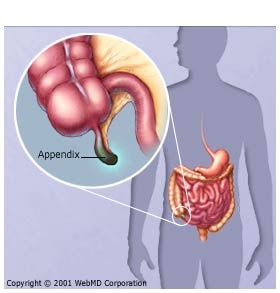 digestive_diseases_appendicitis_appendix